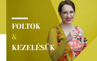 Foltok kezelése: májfolt, pattanásfolt, napfolt: előtte-utána fotókkal!